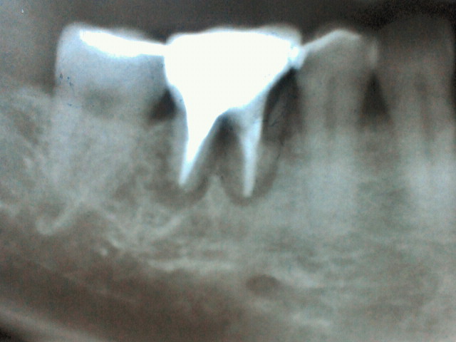 2011042120130000-5.jpg