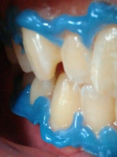 2012081520580001-5.jpg