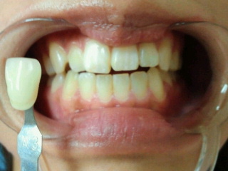 2012081521010001.jpg