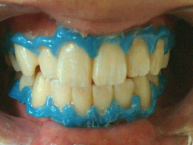 2012081521020000.jpg