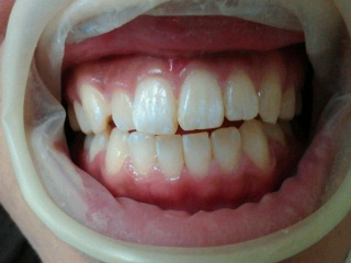 2012082511270000-3.jpg