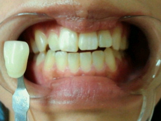 2012082513110000-3.jpg